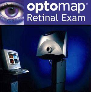 optomap1